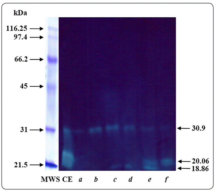 1405-888X-tip-22-e183-gf2.gif